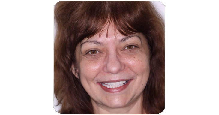 ProDentim Review Image 2